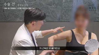 Tummy-Tuck-Liposuction-and-Fat-Grafting-na-yeon01