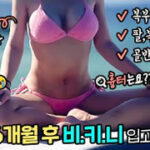 Tummy-Tuck-Liposuction-and-Fat-Grafting-na-yeon05