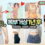 Tummy-Tuck-Liposuction-and-Fat-Grafting-na-yeon06