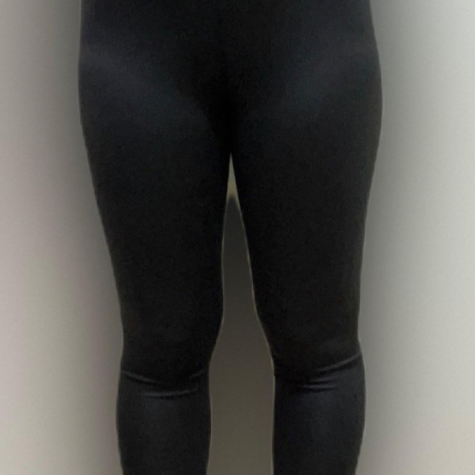 thigh-liposuction-before-selfie