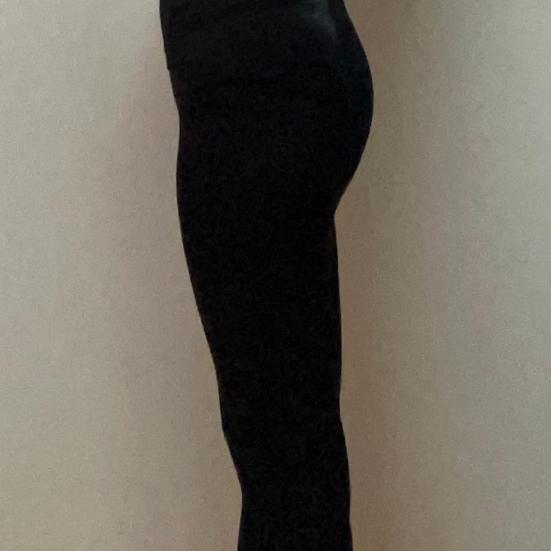 thigh-liposuction-after-selfie-akfogeiv