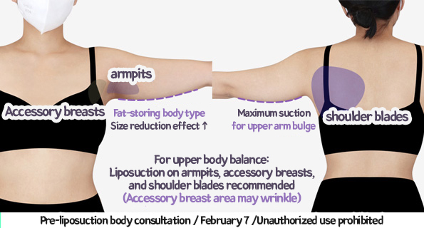 arm_liposuction_02_04_231226