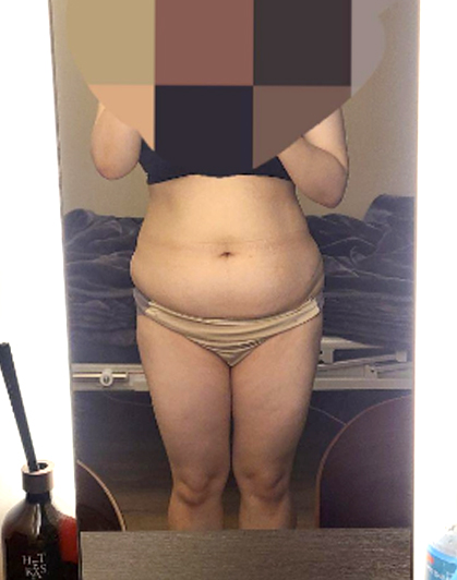 before-Bombambbang2
