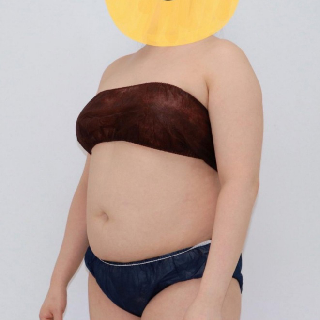 before-Dujumeok