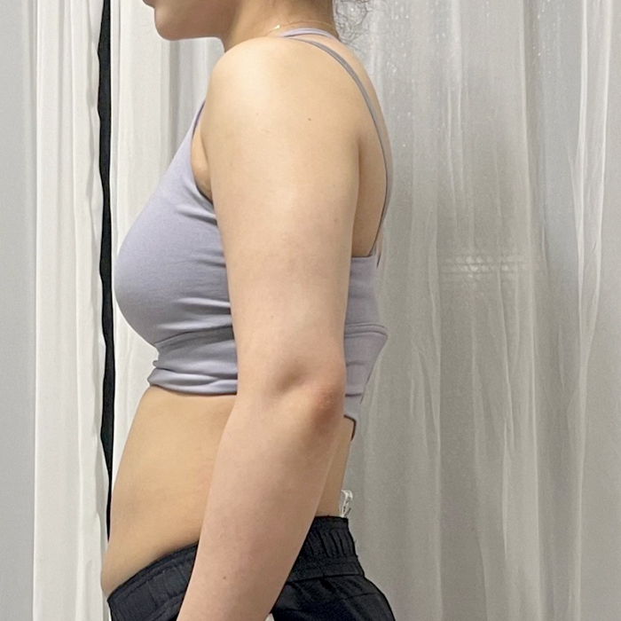 before-Kkossoong