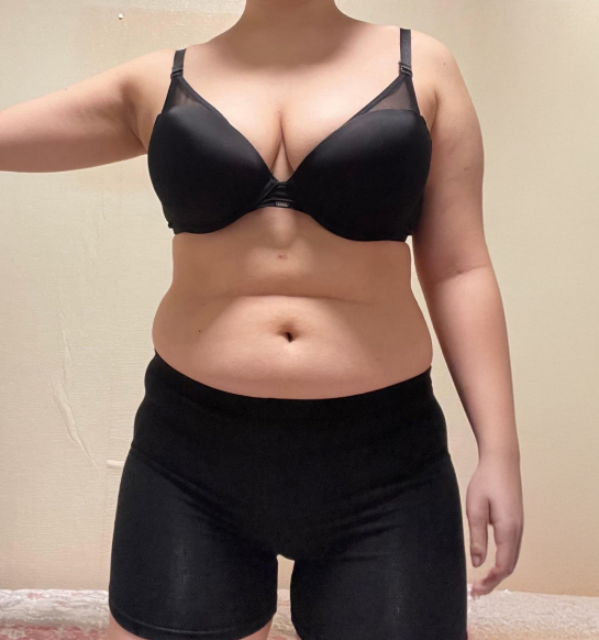 before-Tokkiuglxl