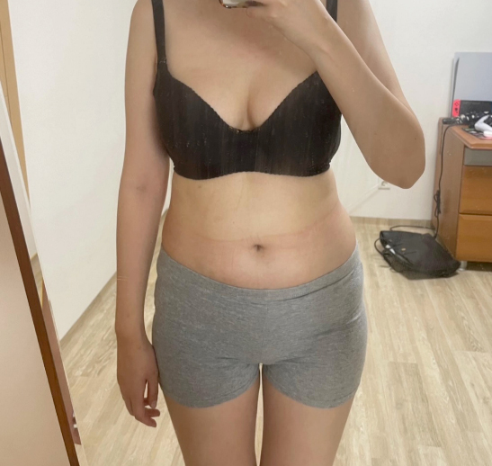 before-dduddoobidap2