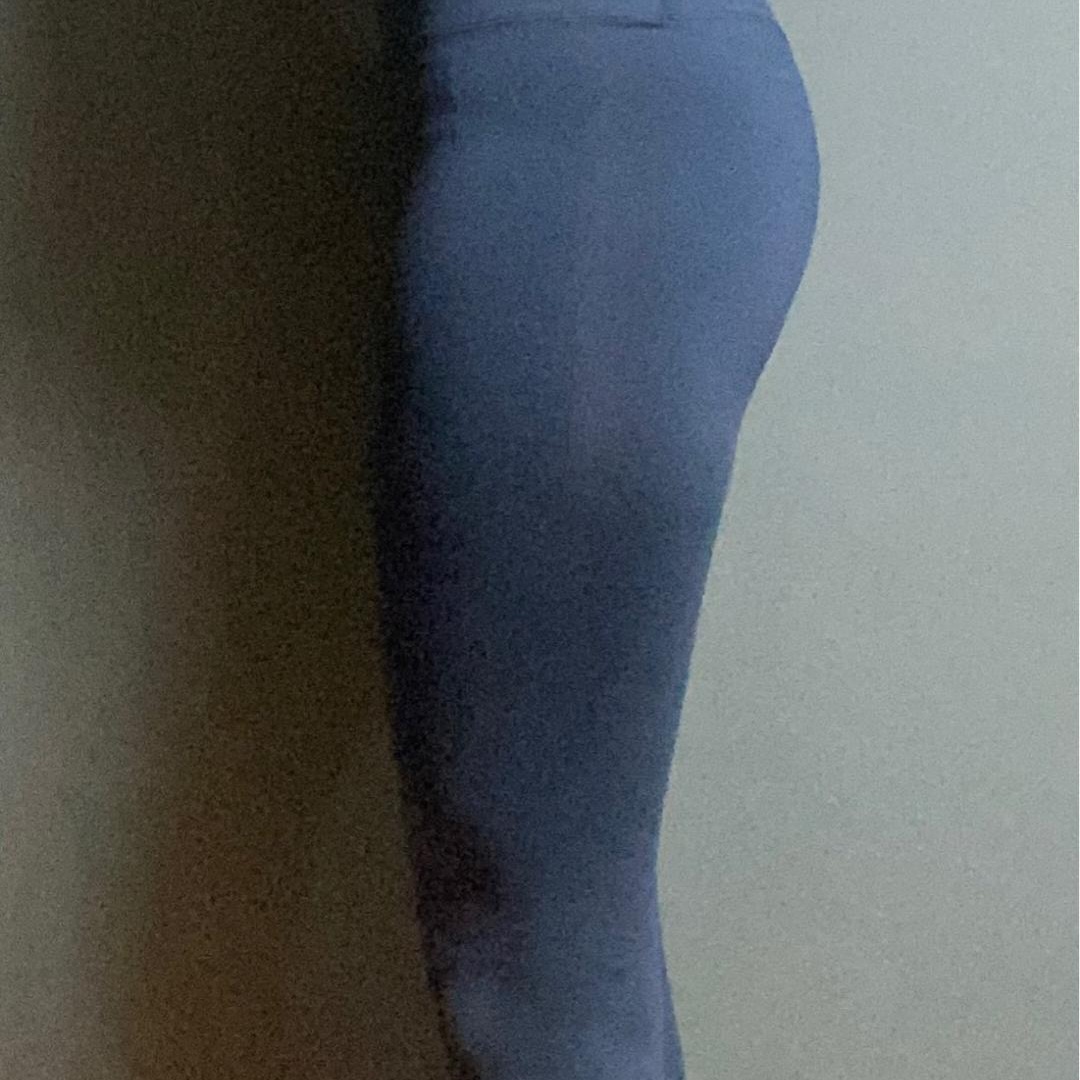Before side