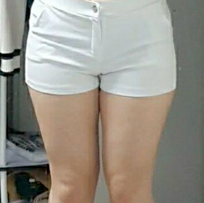 before-yndo2