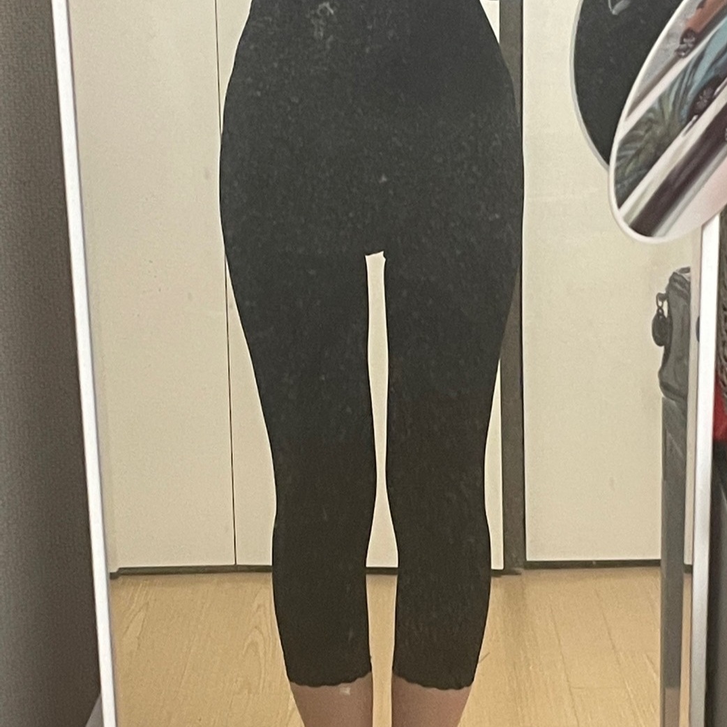 thigh-liposuction-3-mon-after_Sappo
