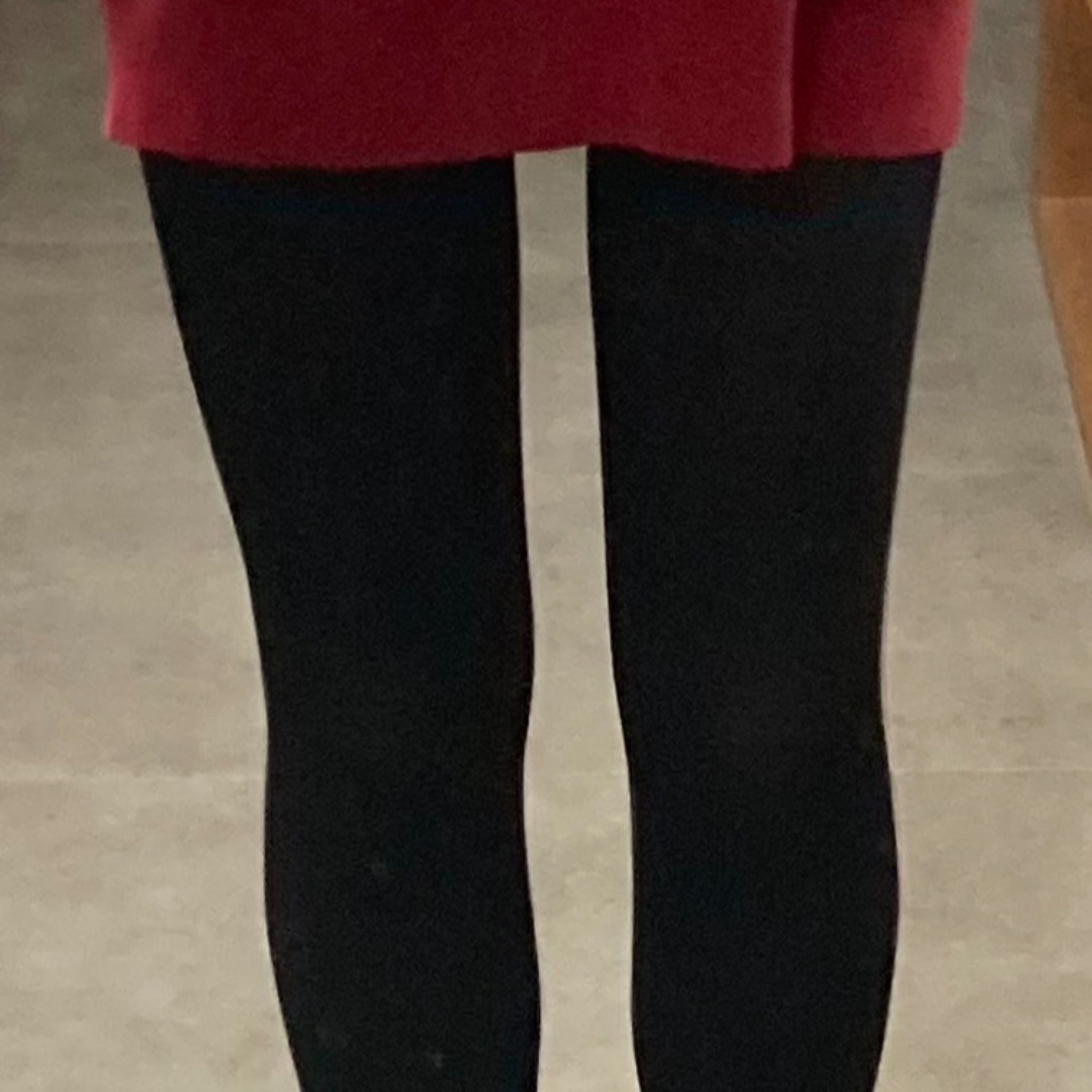 thigh-liposuction-after-selfie3