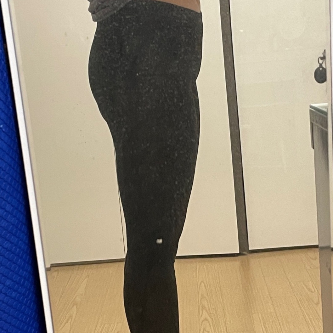 thigh-liposuction-before_Sappo2