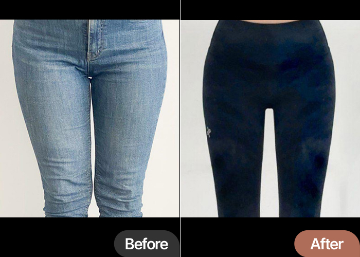 thigh-liposuction-thumbnail-selfie-Kkingkangkkongkkung