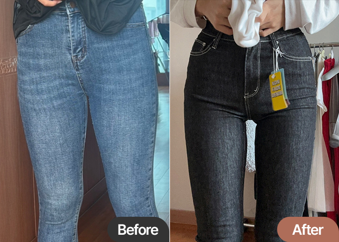 thigh-liposuction-thumbnail-selfie-Tteokbokhoe