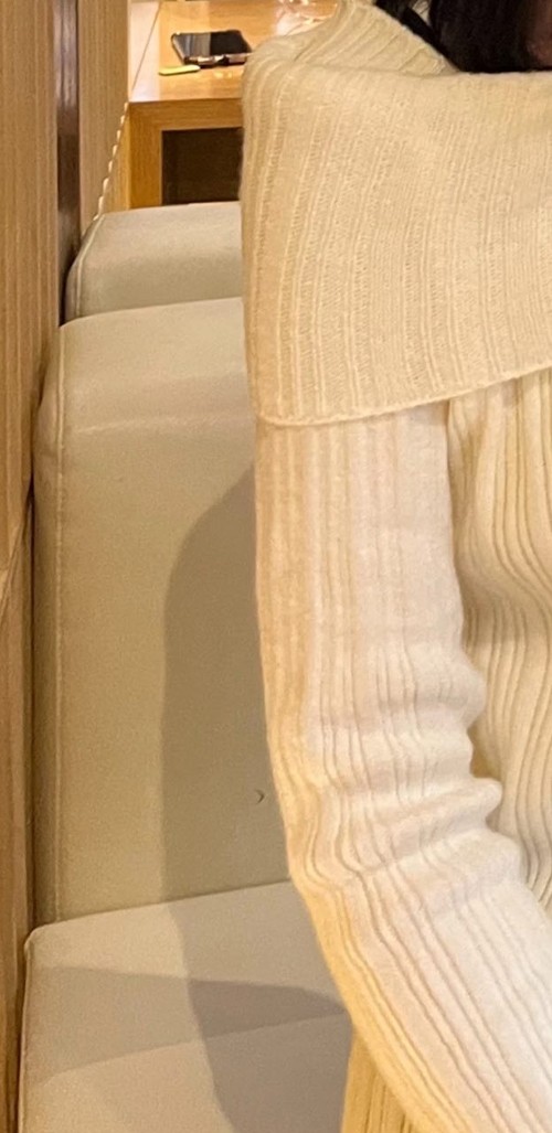 After arm liposuction of Bbongbbongo in Korea—tight beige knit sleeve shows smooth, lean arms.