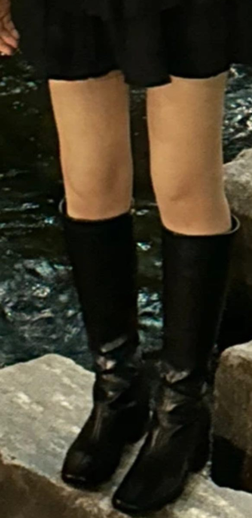 After thigh liposuction of Bbongbbongo in Korea—black shorts and boots, slim legs with no outer bulge.