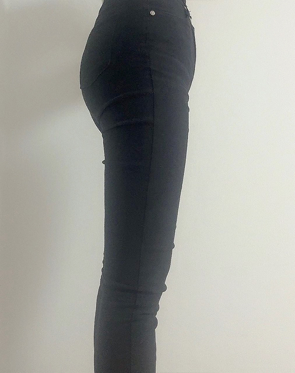 Side view after thigh liposuction in Korea, revealing tightened outer thigh contour in slim-fit pants.