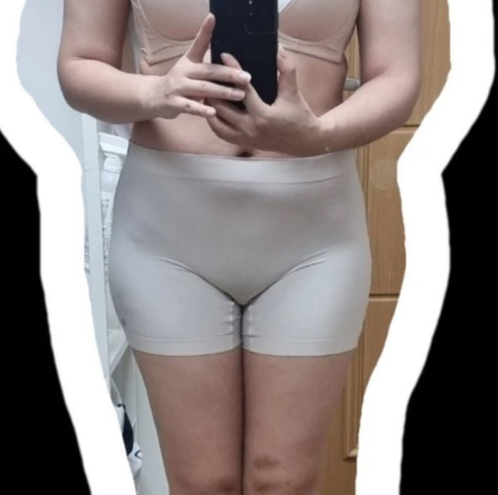 Before thigh and abdominal liposuction of Gangnam1deung in Korea—front view in beige shorts, visible thigh gap absent and lower belly protruding.