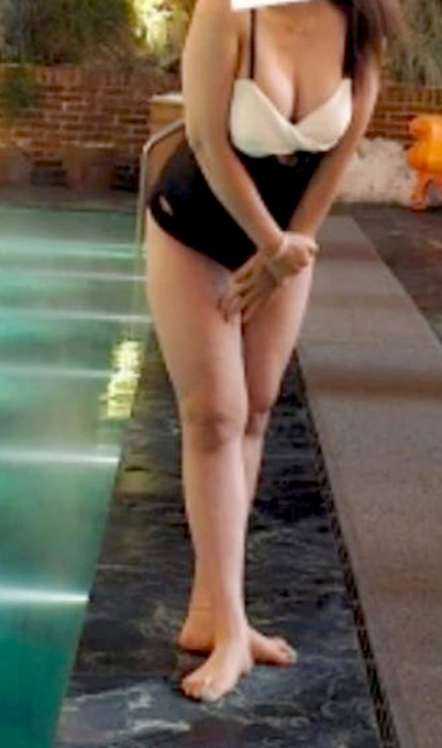 Before thigh liposuction of GudGudJjang in Korea—standing near pool in black swimsuit, inner thighs visibly touching.