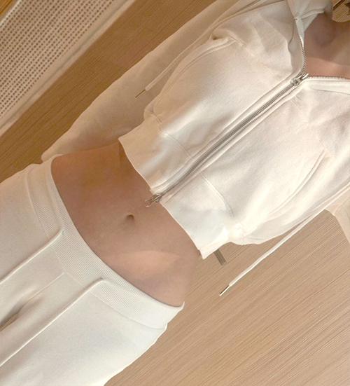 After hip fat transfer of Hari in Korea—high-waisted skirt shows slim waist and curved lower body.