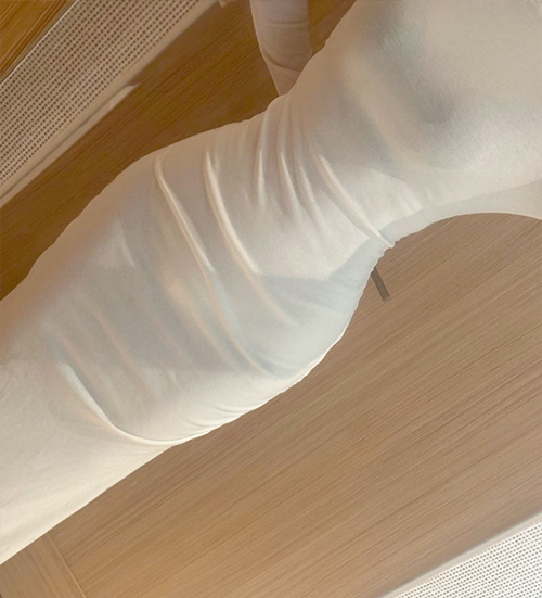After abdominal liposuction of Hari in Korea—wearing white compression garment, smooth waist curve visible.