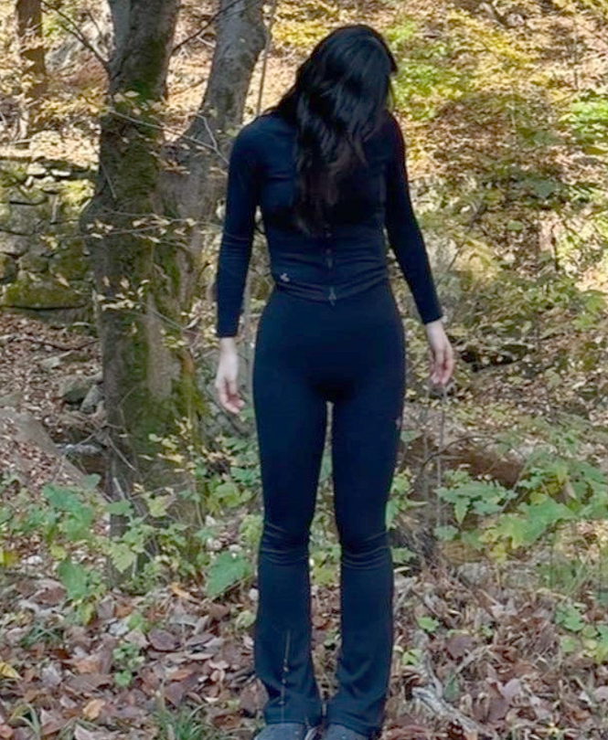 8-week post-op image of Izziring after arm and thigh liposuction at Lesarts, showing emerging thigh gap and smooth arm line.