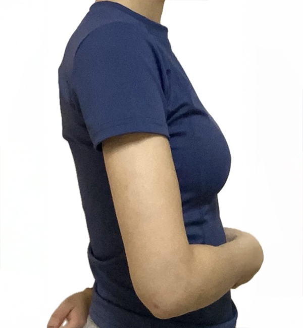 Back and side view showing slimmer silhouette after liposuction by Janzanjjanjjan