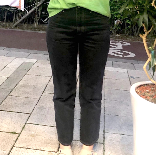 Before thigh liposuction of Jjondeokhouse in Korea—front view in black pants, legs appear bulky and straight.
