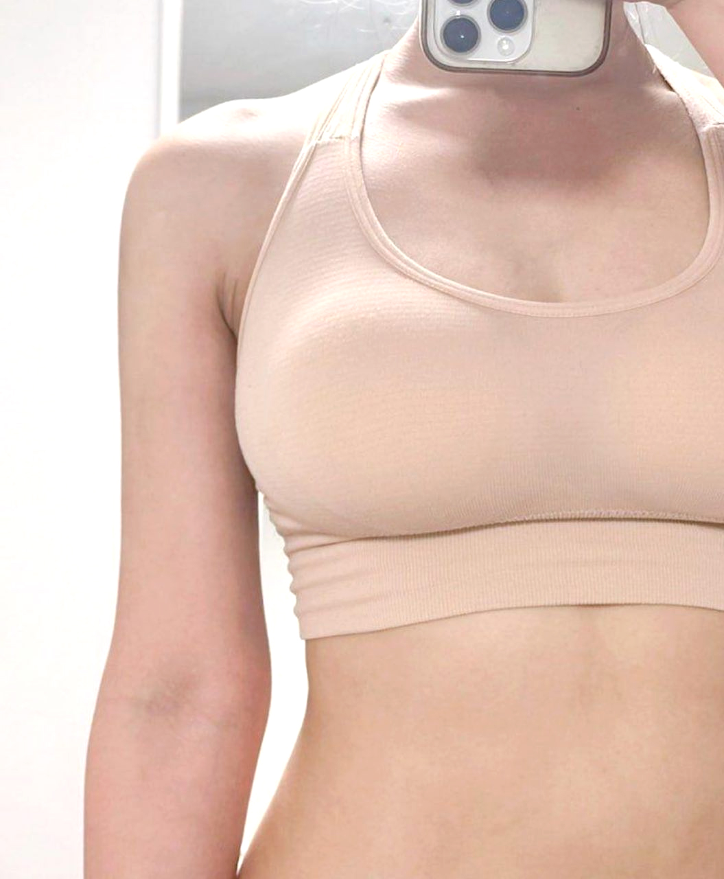 After accessory breast removal of Jorollo in Korea—sleeveless beige top reveals flat underarm contour.