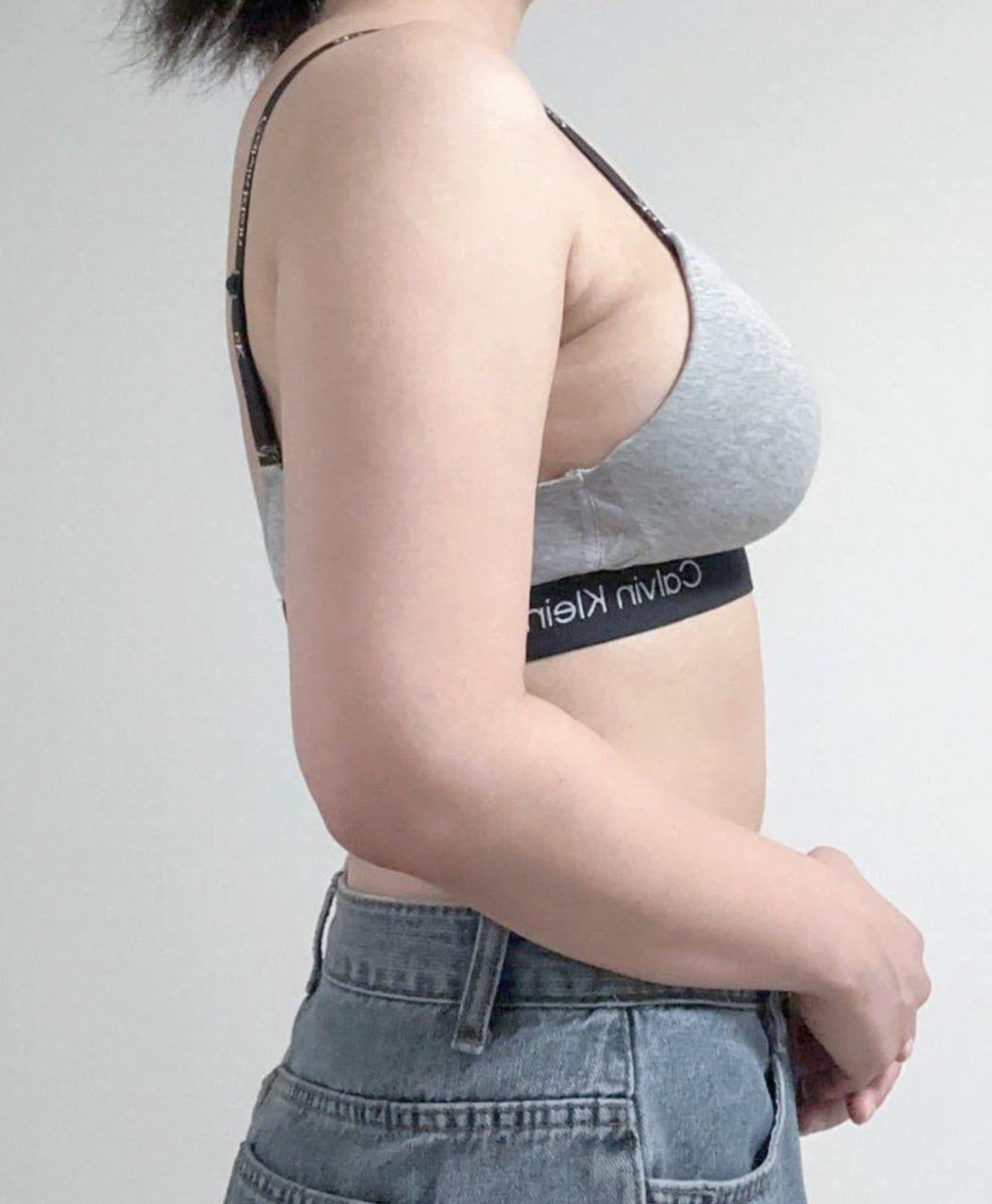 Before arm liposuction of Jorollo in Korea—side view in gray sports bra, visible bulge around armpit.