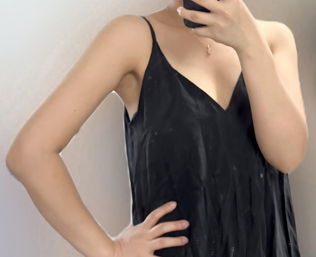 Confident pose in sleeveless outfits after arm fat removal surgery
