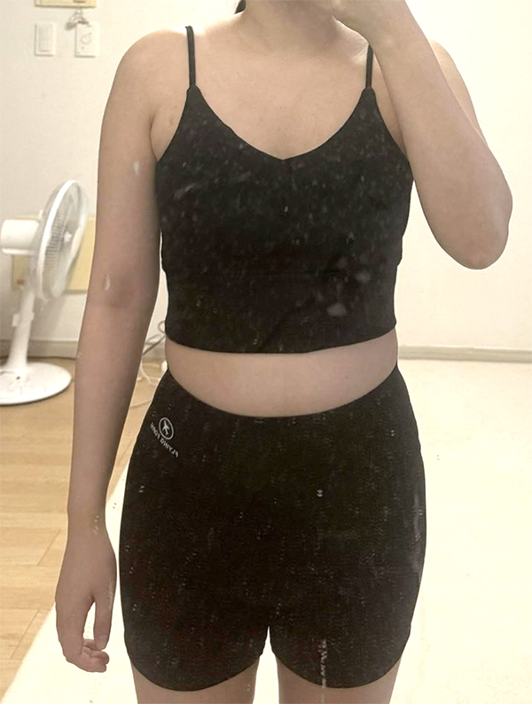 Before abdominal and thigh liposuction of Lucia00 in Korea—front view, visible belly and tight inner thighs.