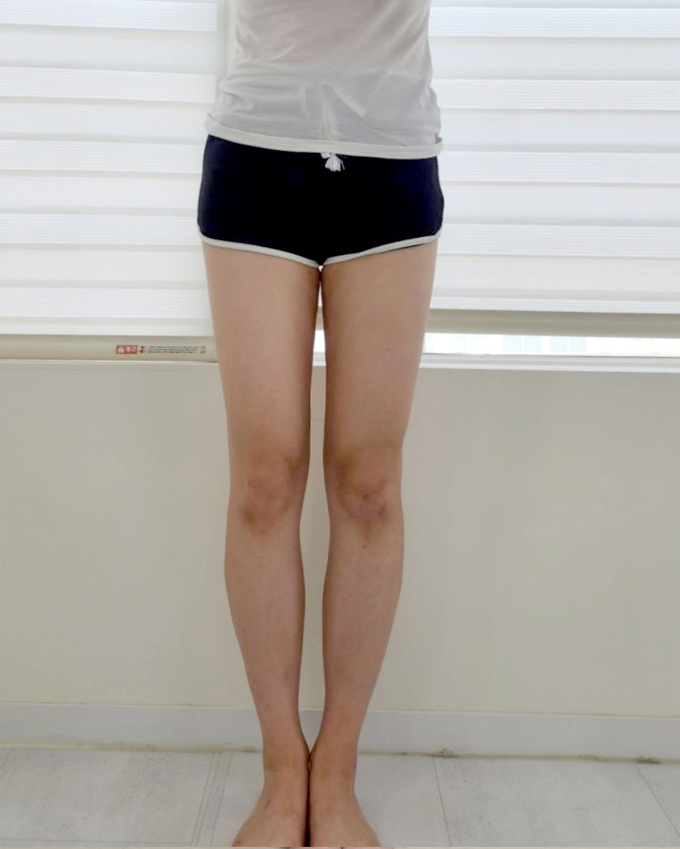 Niini-after