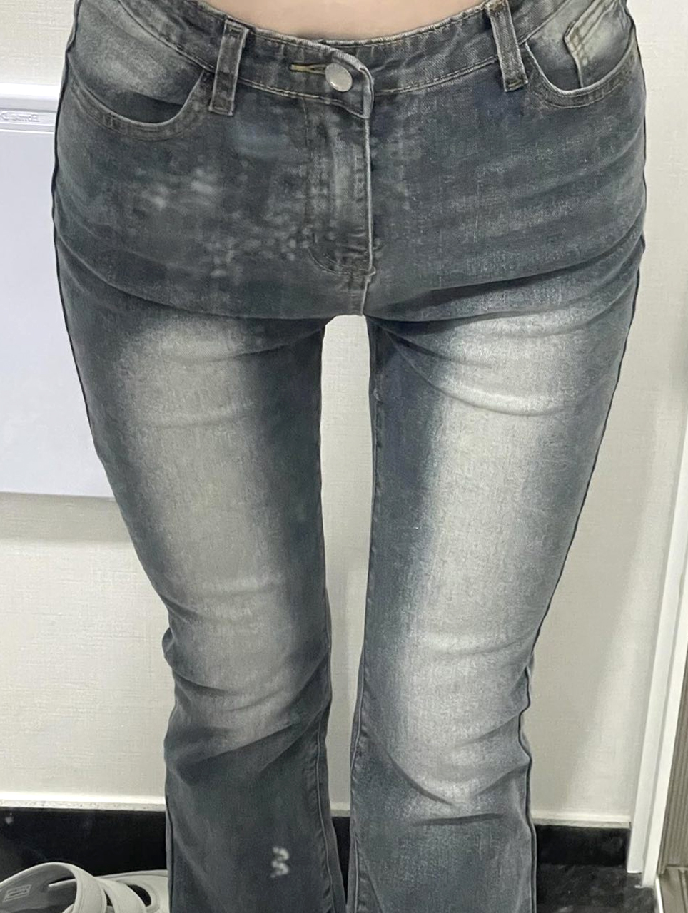 Thigh liposuction hip line NyangiQesco