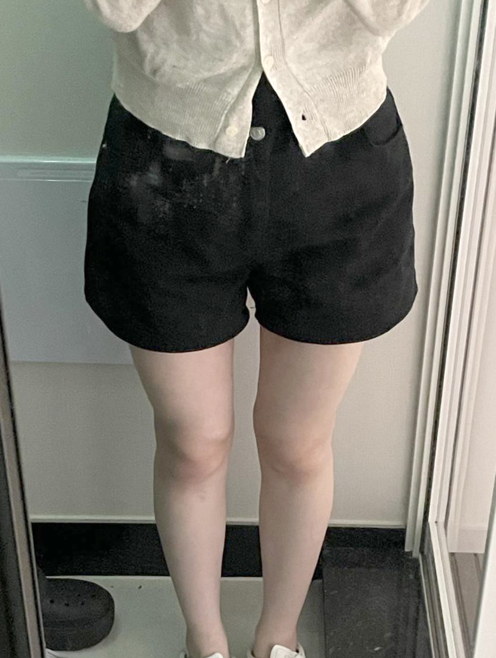 Thigh liposuction hip line NyangiQesco