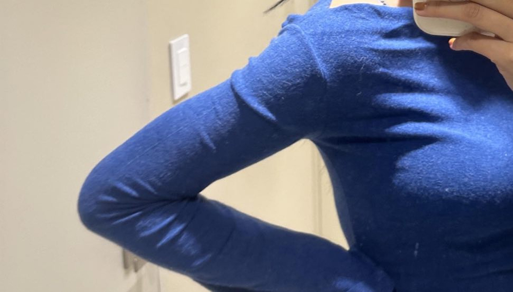 After arm liposuction of Nyangiq4BuF in Korea—wearing fitted blue top, arms flexed showing toned line.