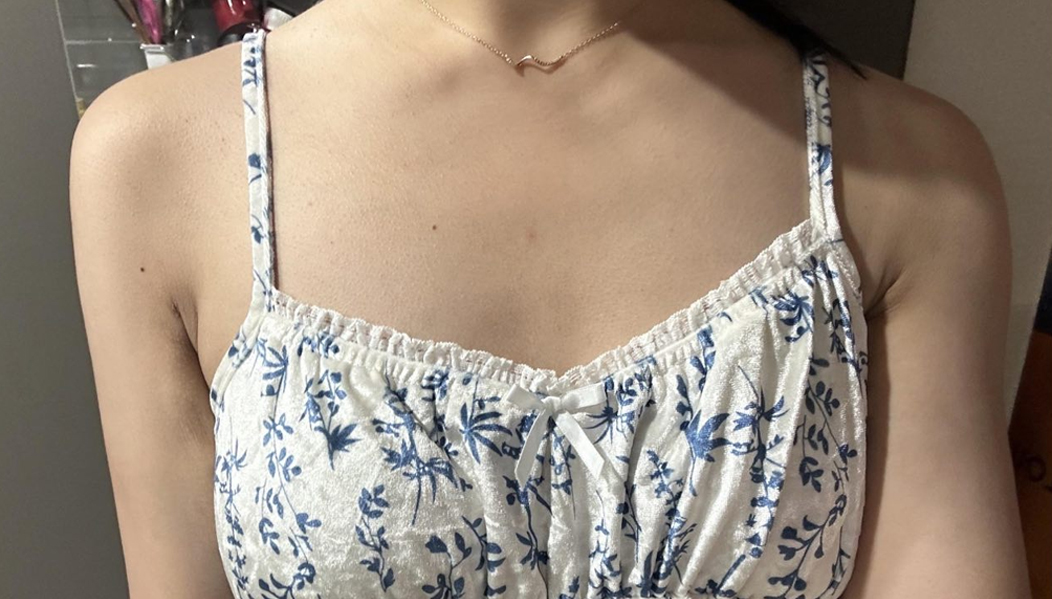 After arm liposuction of Nyangiq4BuF in Korea—floral sleeveless dress front view, soft and defined shoulders.