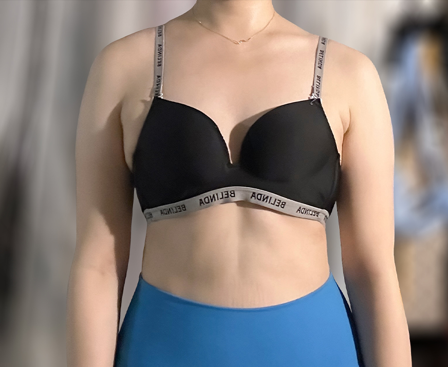 Before photo of Nyangiq4BuF in Korea showing thick upper arms in tight black bra top.