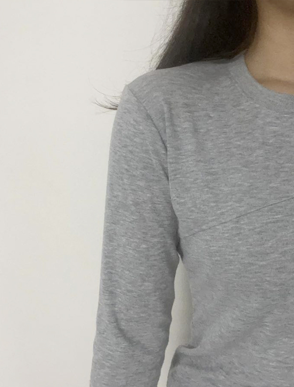Front view showing loose fit of the same shirt post-surgery