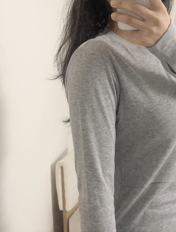 Slimmer arm line after arm liposuction at Lesarts Plastic Surgery in Korea