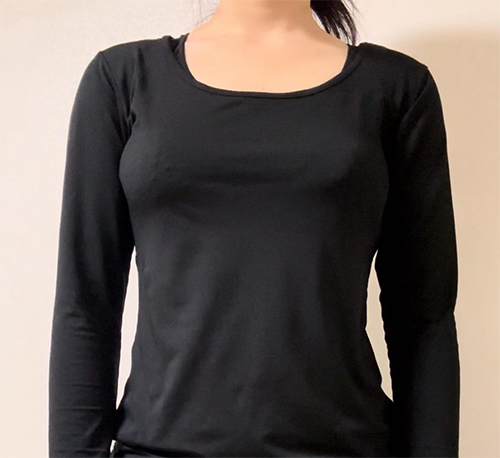 After arm liposuction of Roroppungppangyi in Korea—black top fits loosely with slimmer arm shape.