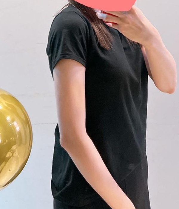 After upper body fat removal of UnniVLeS5o in Korea—arms, shoulder and side profile show smooth contour.