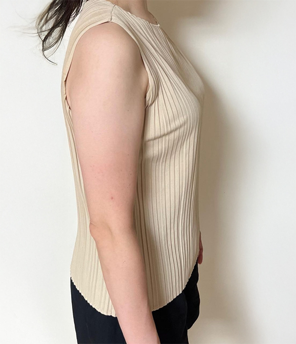 Before arm liposuction of UnniVLeS5o in Korea—side view in sleeveless beige top, upper arm appears thick and rounded.