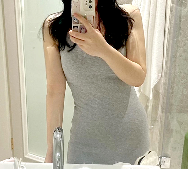 Post-op image of Yeonikkot wearing a fitted gown showing toned arms and side waist.