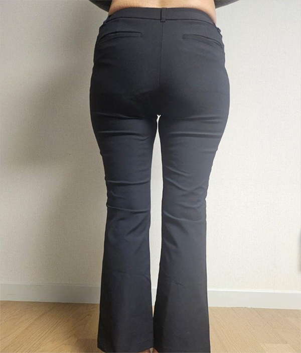 Before thigh liposuction of YeouKmC23 in Korea—back view in pants, inner thigh area shows volume and no gap.