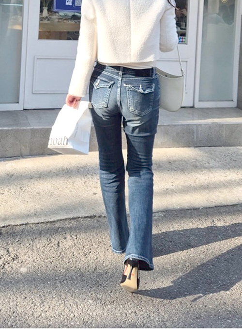 Jeans fitting loosely after thigh fat removal surgery