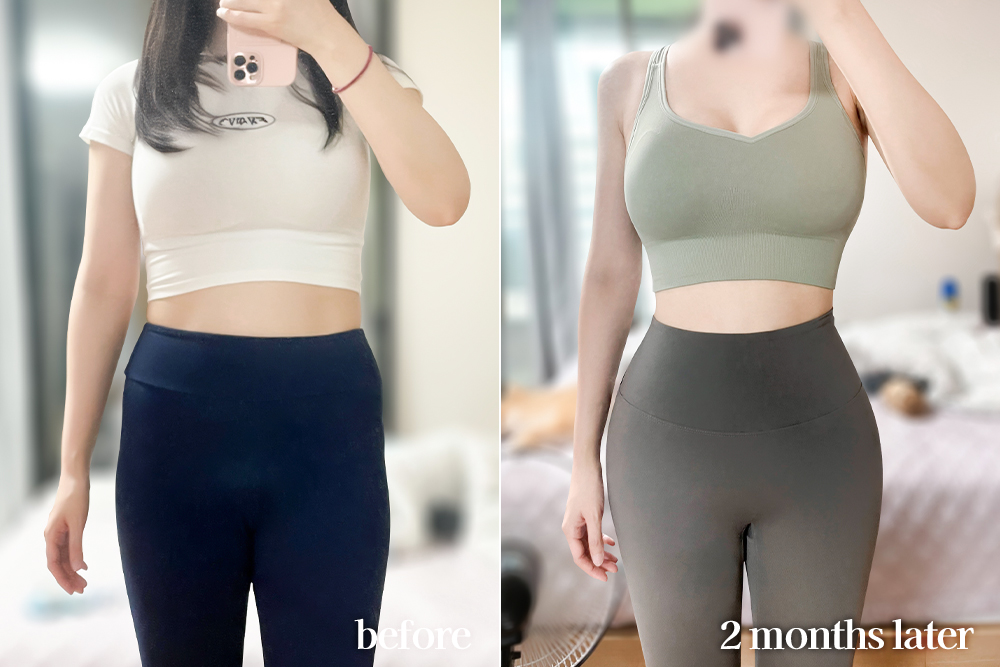 AbdominalLiposuction-review