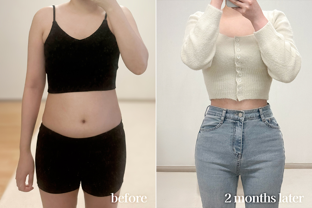 AbdominalLiposuction-review