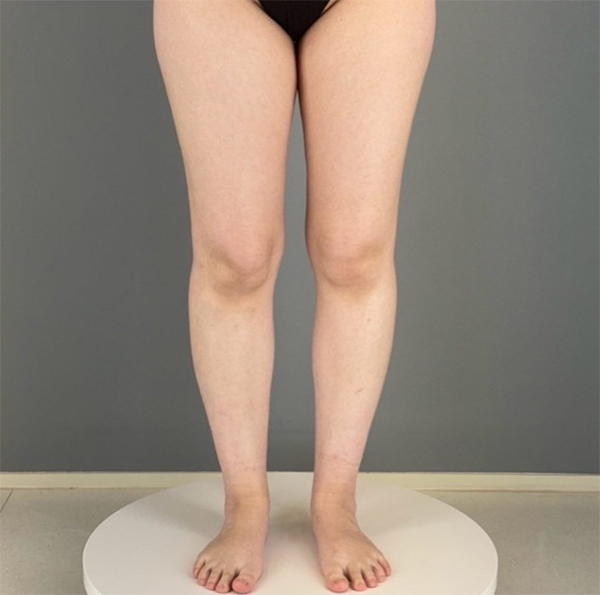before-Baegopak