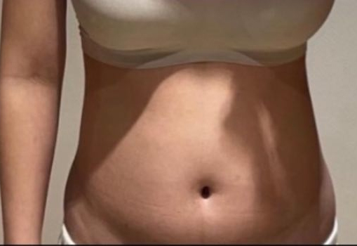 before-ureureu